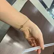 缩略图 1