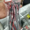 缩略图 1
