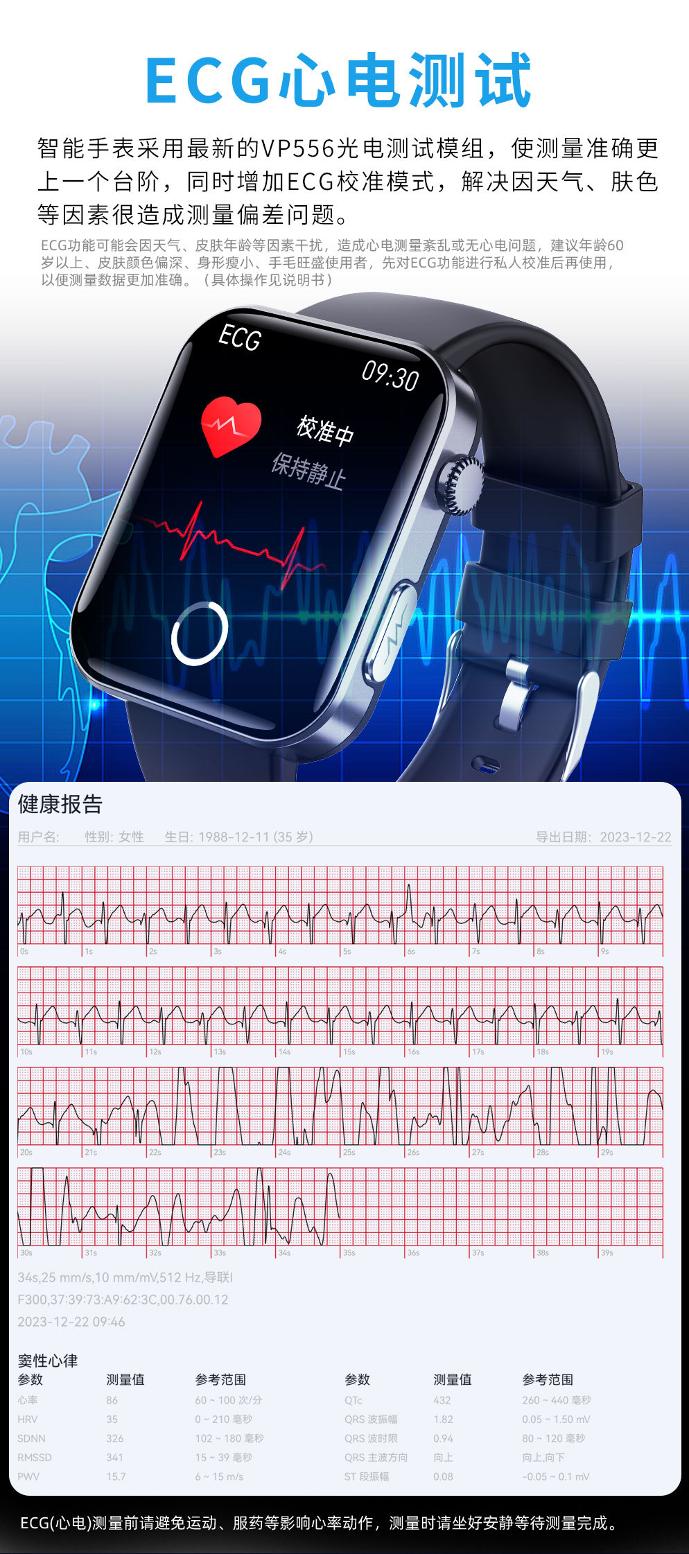 F300中文详情页_03.jpg